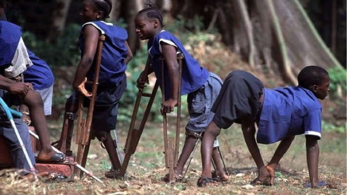 The Physically Challenged Association in Bauchi State has raised concern over the persistent stigmatisation faced by polio survivors, saying the situation continues